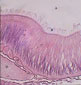 Cæcum « hépatique », intestin x4