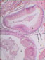 Cæcum « hépatique », intestin x2,5