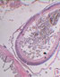 Entre cæcum « hépatique » et atriopore
