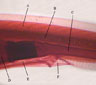 Amphioxus/Amphioxus atriopore